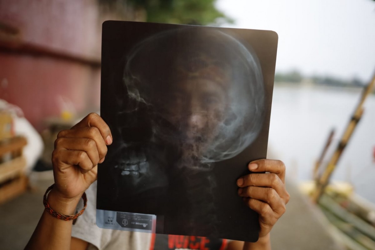 Edi berpose dengan medium X-ray di tepian kali Cisadane